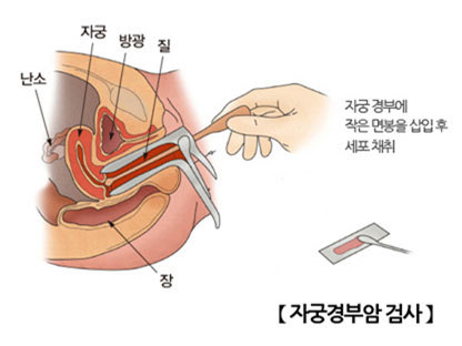 이미지명